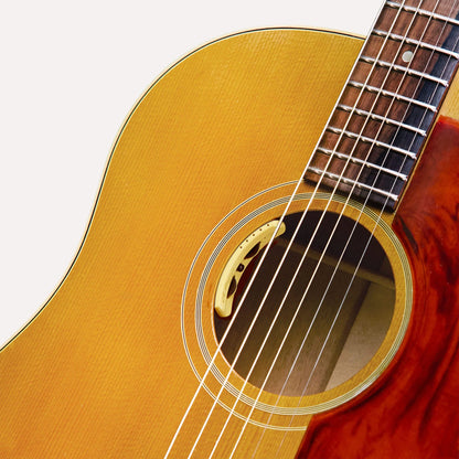 LR BAGGS ANTHEM  Acoustic pickup system